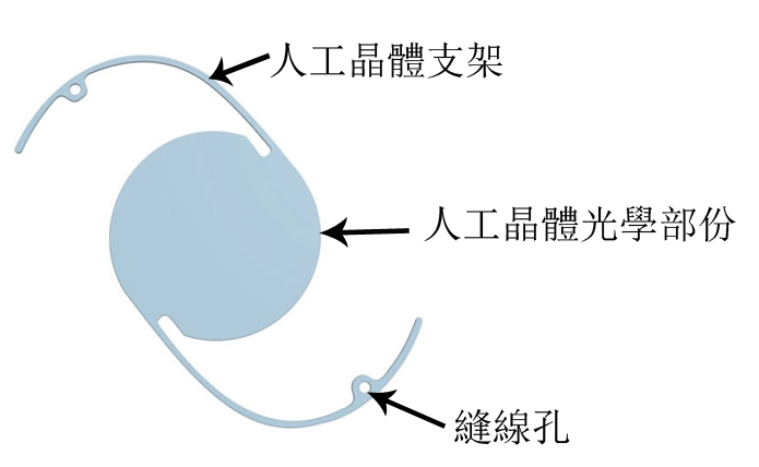 昆明白内障晶体价格,白内障手术晶体能报销吗?